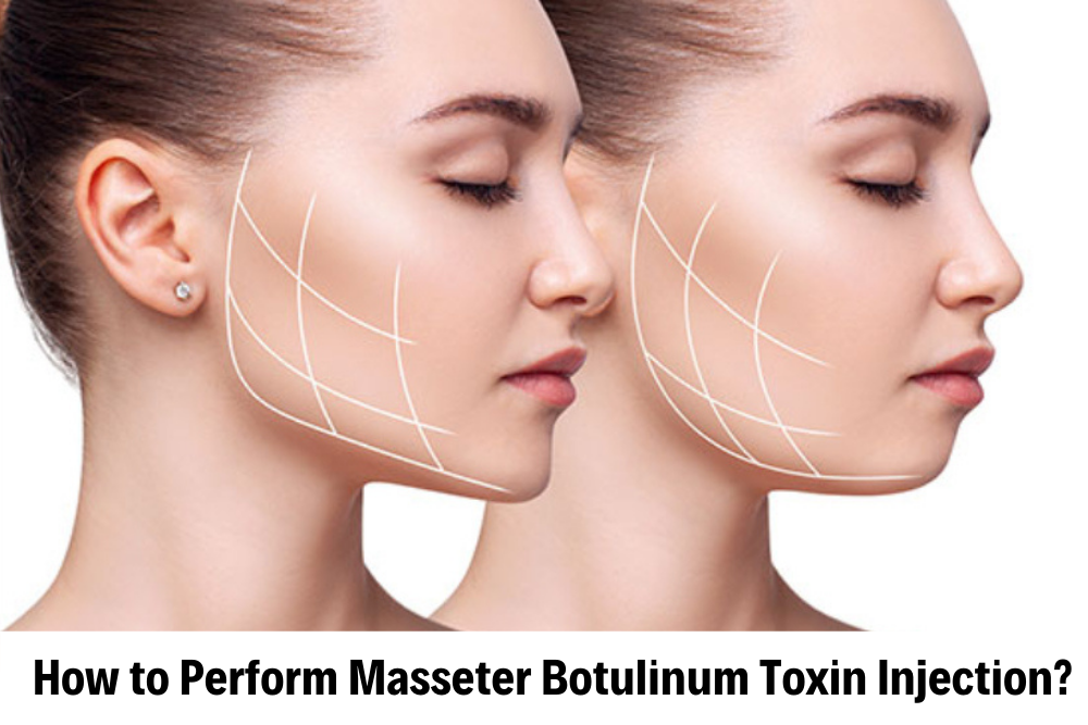 Masseter Treatment